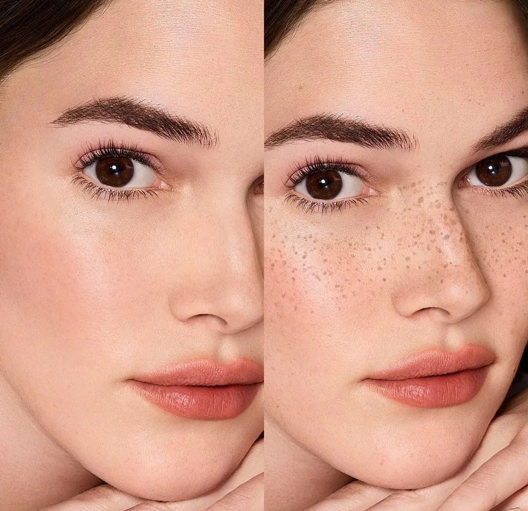 Antes y después del efecto de pecas